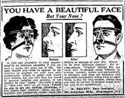 First Plastic Surgery in Britain
